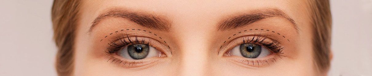 Blepharoplasty Marbella